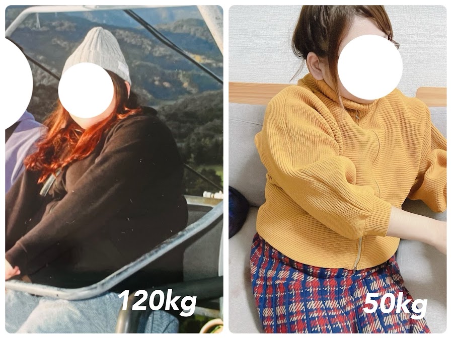 筆者水無瀬まみのダイエットビフォーアフター 120kgから50kgへの減量